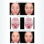 GF5 Case study GF5 Next Generation case study redness pores texture
