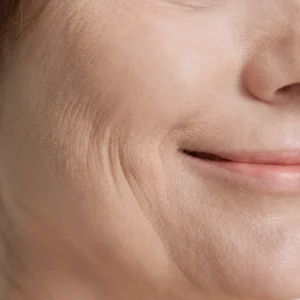 Close-up of fine lines for CellDerma ageing skin concern category