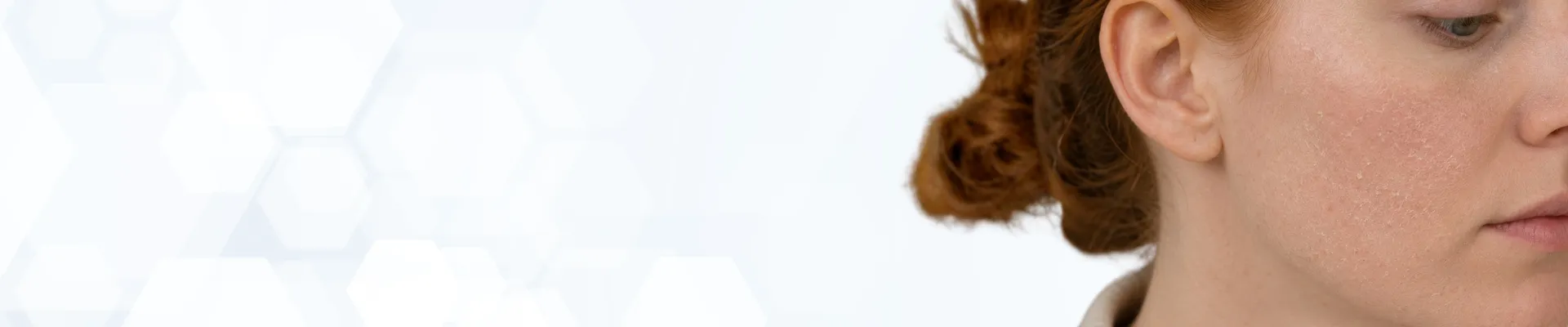 Dry-Skin-Hero-Banner