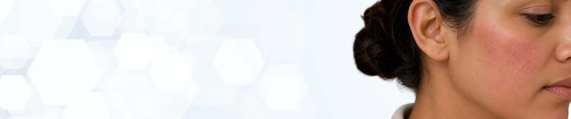 Sensitive-Hero-Banner-30-1