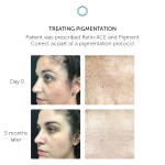 PIGMENT CORRECT