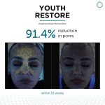 Youth Restore case study pores reduction