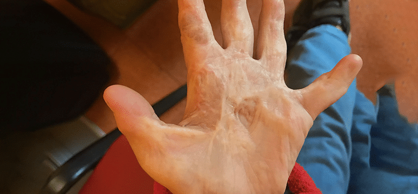 CellDerma Hands Tulsi Vagjiani Content Image