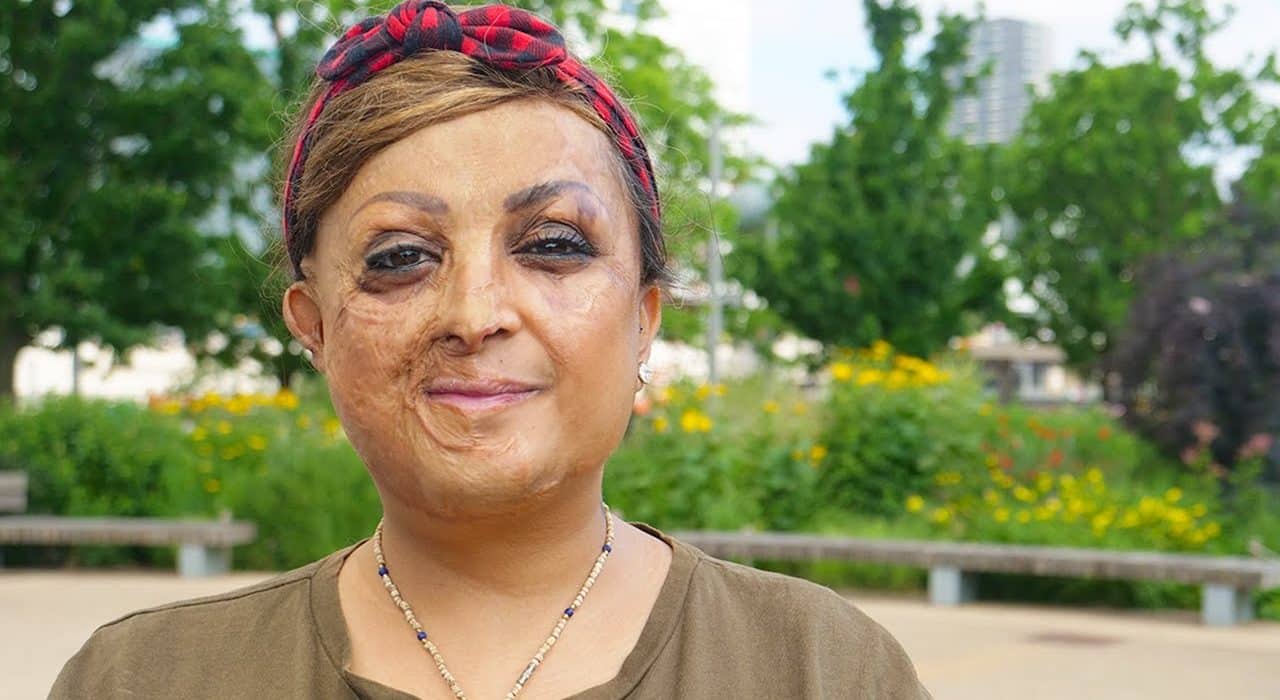 CellDerma Mature Woman Face Smiling Tulsi Vagjiani Content Image