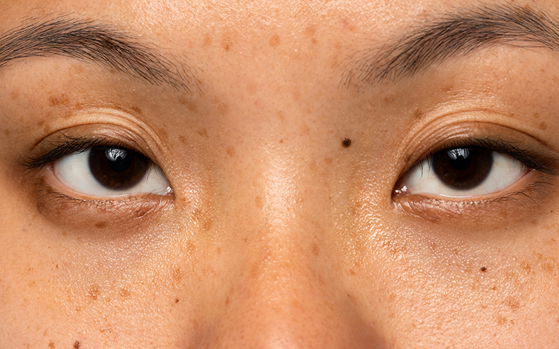 What is pigmentation?