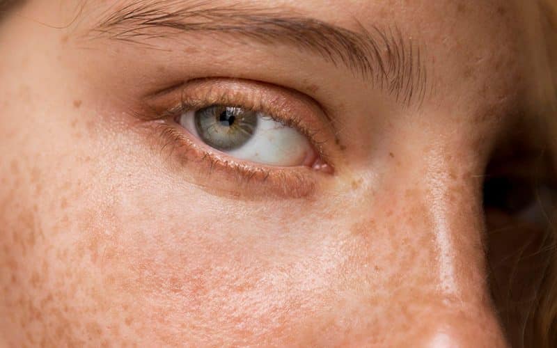 A redhead woman with a close up of her green eye and freckled skin