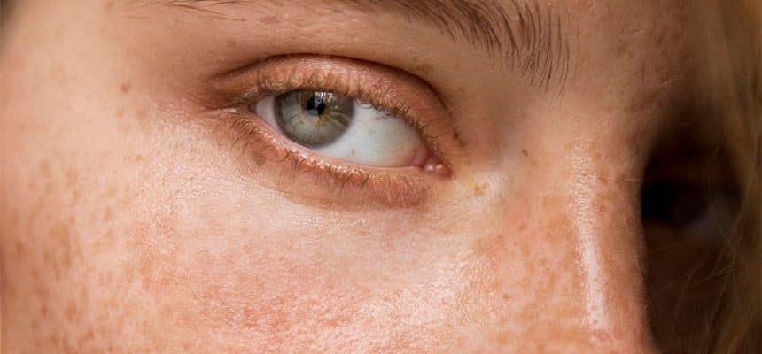 A redhead woman with a close up of her green eye and freckled skin