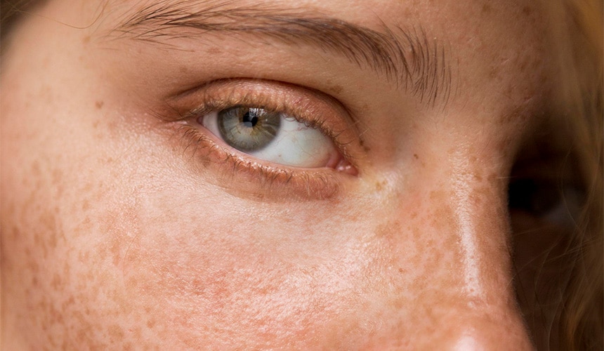 A redhead woman with a close up of her green eye and freckled skin