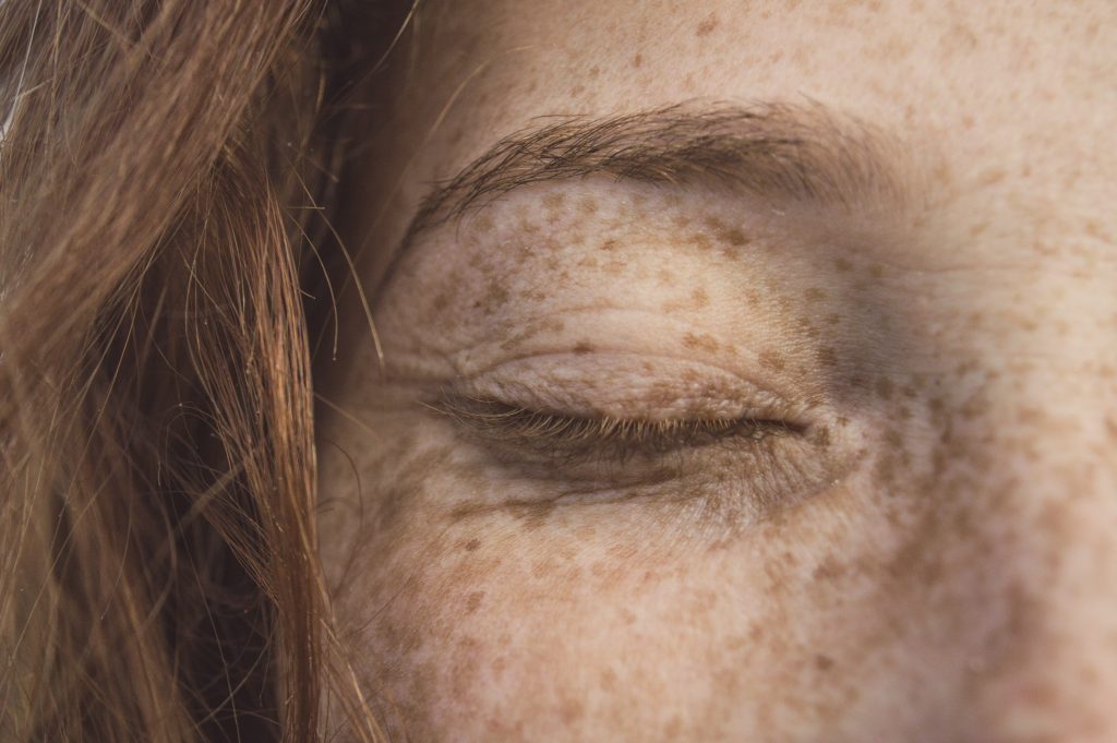 freckles close up of young lady 