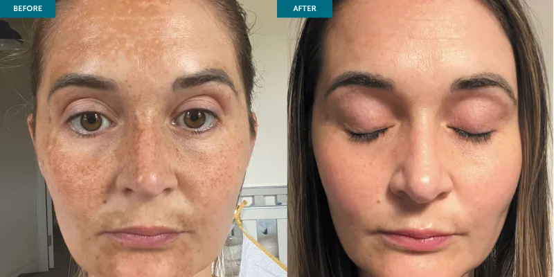 Collagen + Pigment C