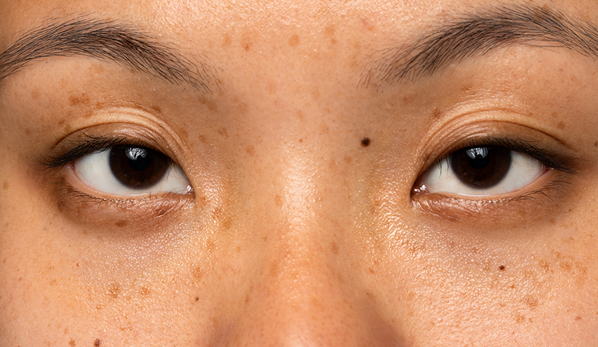 EYES 1